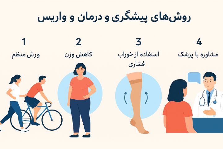 روشهای پیشگیری و درمان واریس